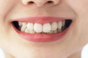 2025年最新!心斎橋で埋没法を検討している方必見の完全ガイド